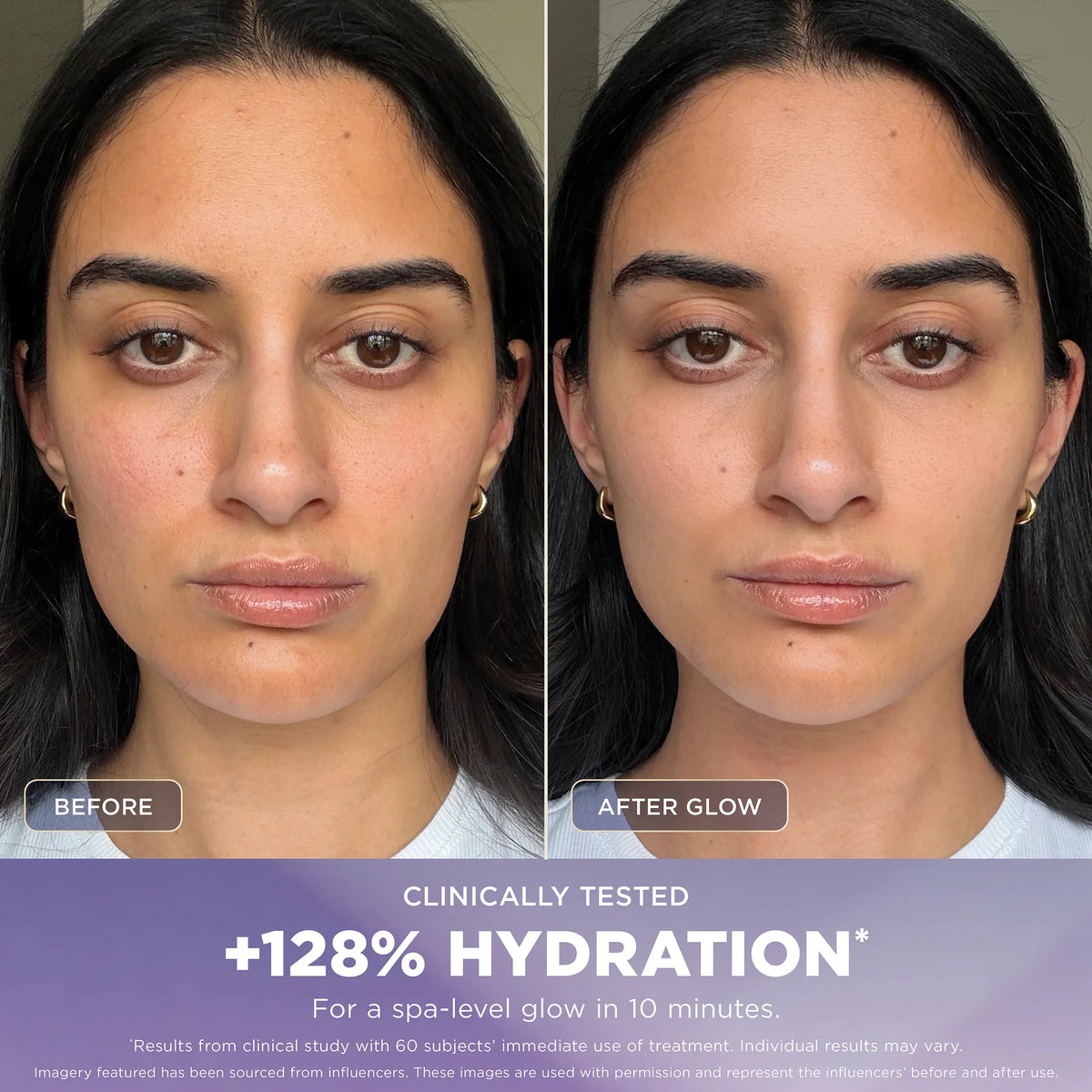 Shark FacialPro Glow