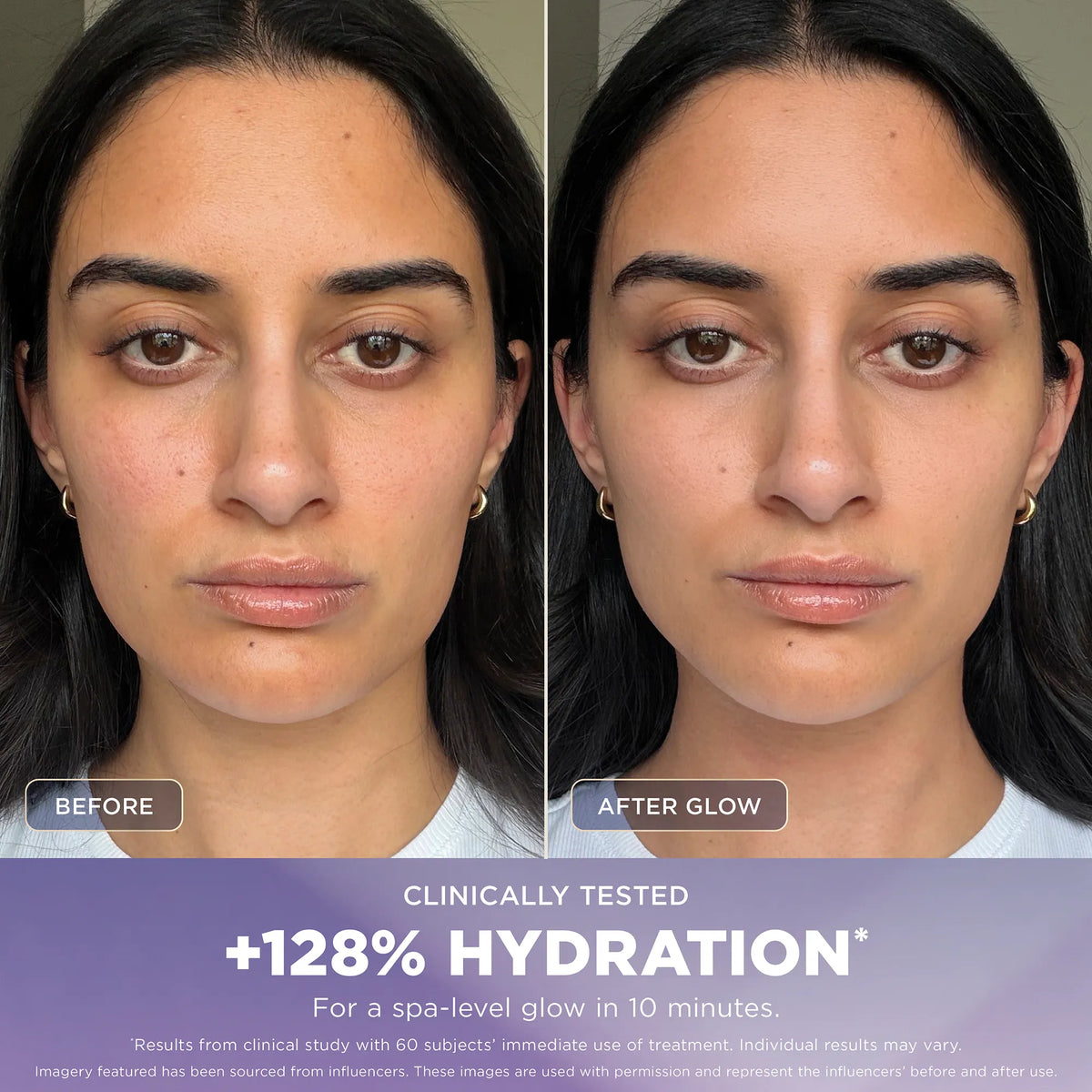 Shark FacialPro Glow